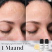 Medik8 Oxy-R Peptides 2x 10ml før og efter resultat