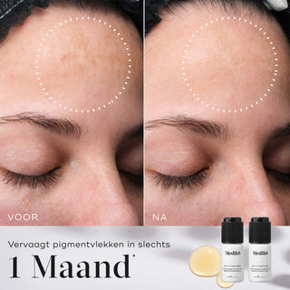 Medik8 Oxy-R Peptides 2x 10ml før og efter resultat