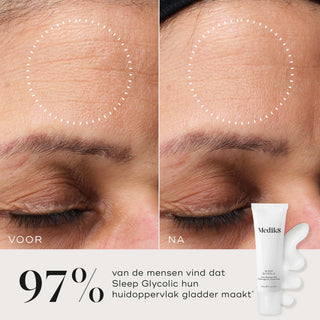 Medik8 Sleep Glycolic 30ml før og efter resultat