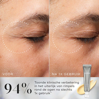 Medik8 Crystal Retinal Ceramide Eye 6 15ml før og efter resultat