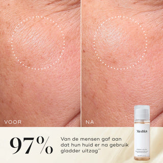 Medik8 Press & Glow Refill 200ml før og efter resultat