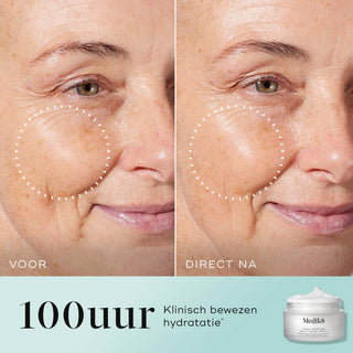Medik8 Total Moisture Daily Facial Cream 50ml før og efter resultat