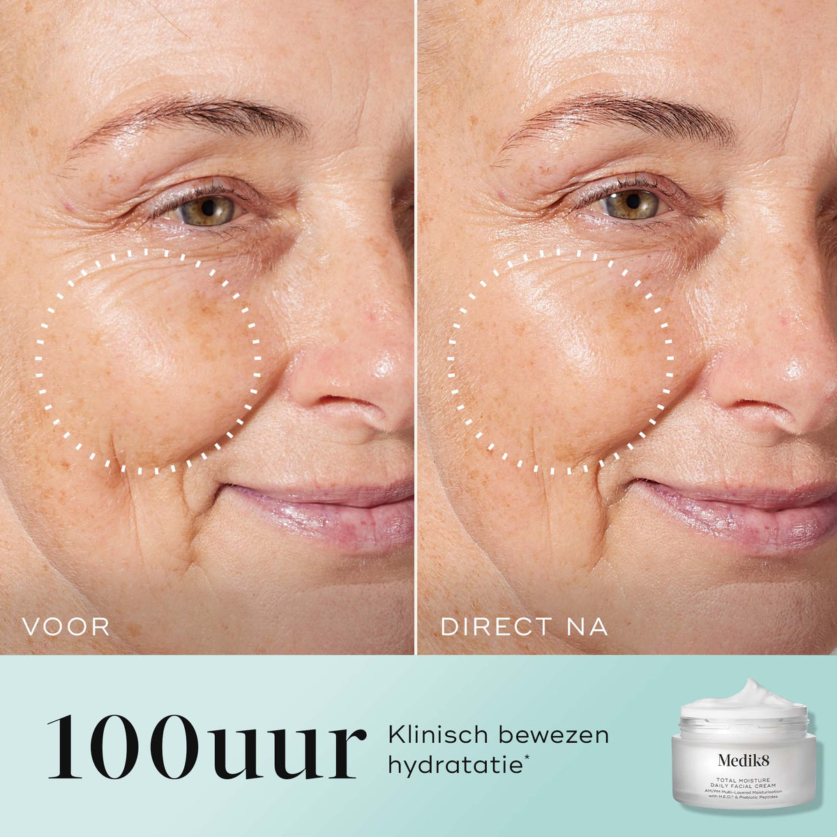 Medik8 Total Moisture Daily Facial Cream - Refill 50ml før og efter resultat