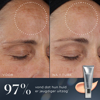 Medik8 Crystal Retinal 10 30ml før og efter resultat
