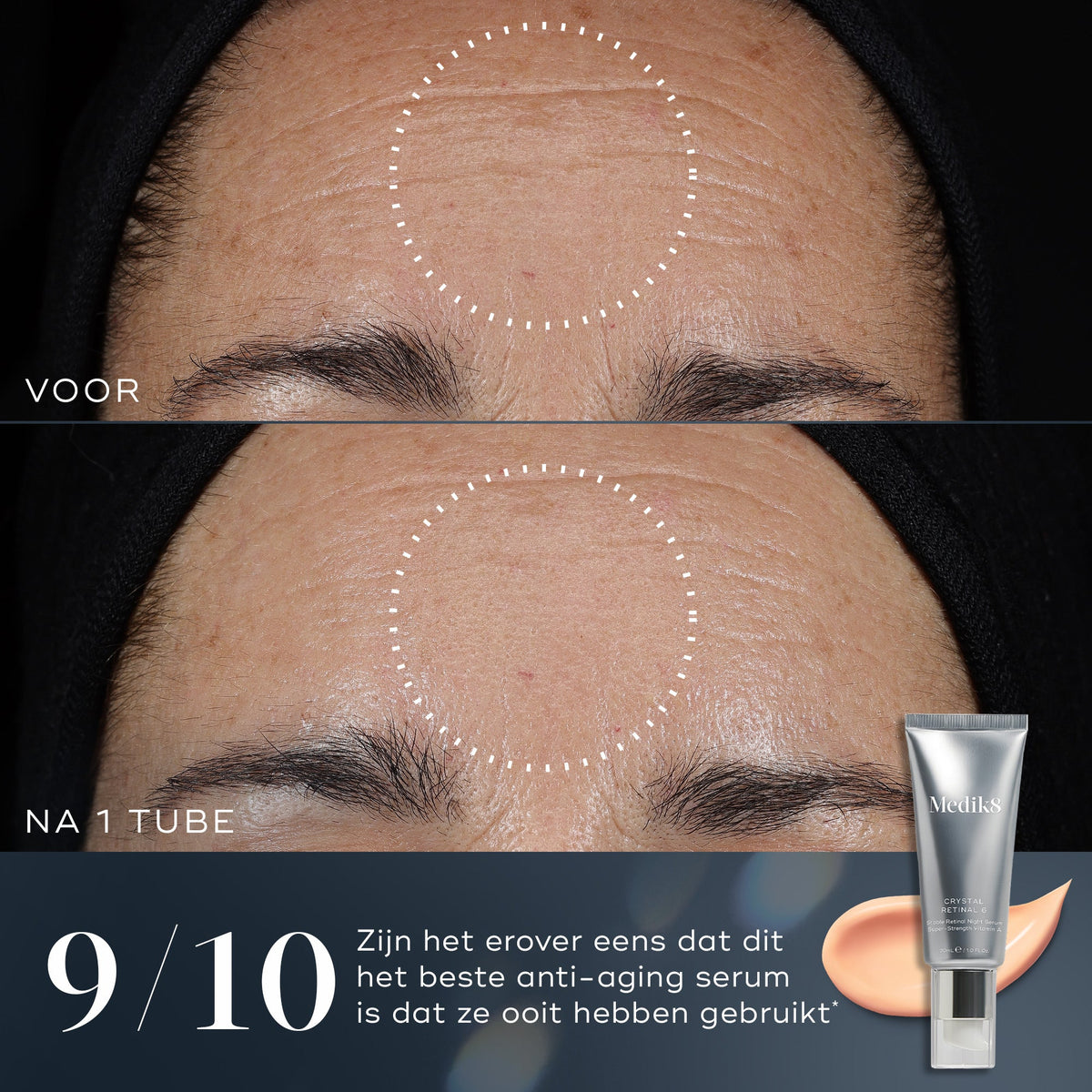 Medik8 Crystal Retinal 24 30ml før og efter resultat to