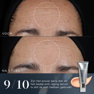 Medik8 Crystal Retinal 24 30ml før og efter resultat to