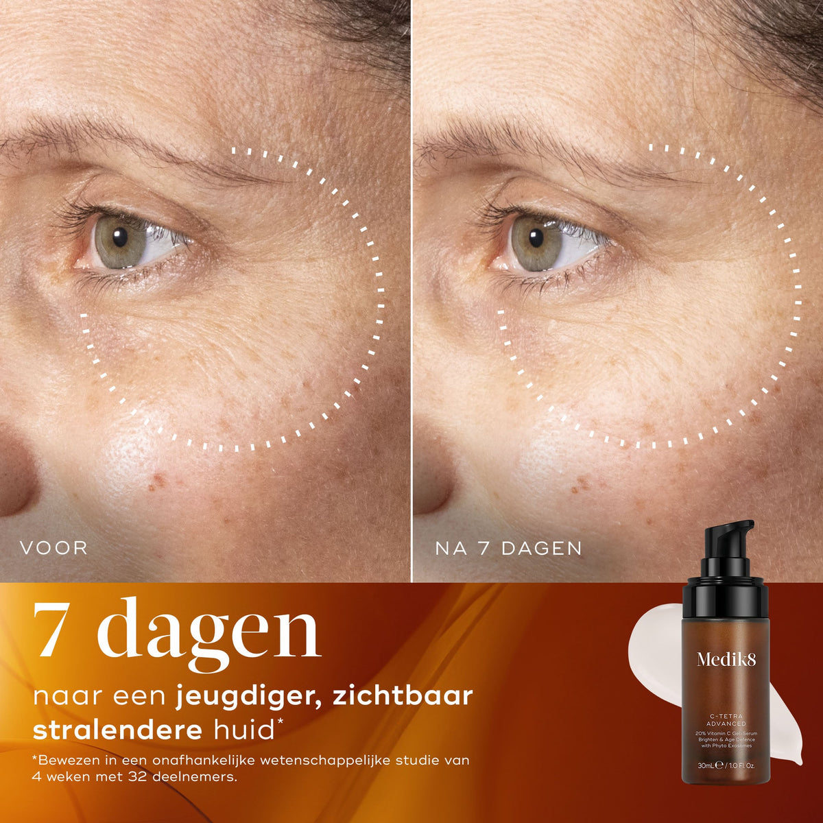 Medik8 C-Tetra Advanced 30ml før og efter resultat