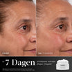 Medik8 Advanced Pro Collagen+ Peptide Cream 50ml før og efter resultat