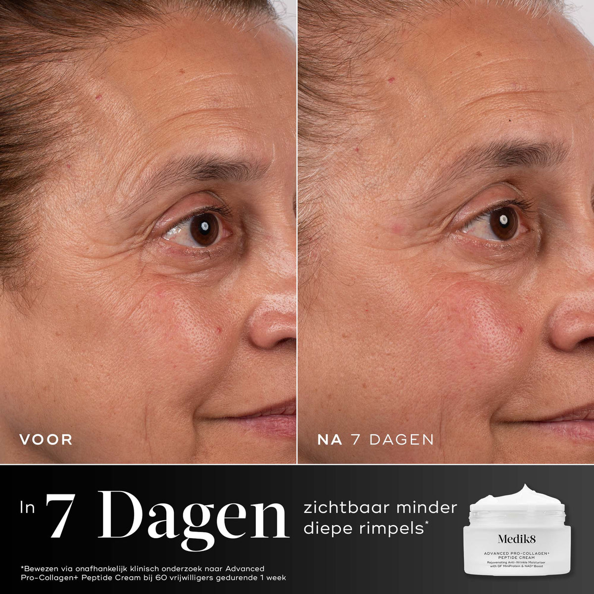 Medik8 Advanced Pro Collagen+ Peptide Cream 50ml før og efter resultat