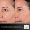 Medik8 Advanced Pro Collagen+ Peptide Cream 50ml før og efter resultat to
