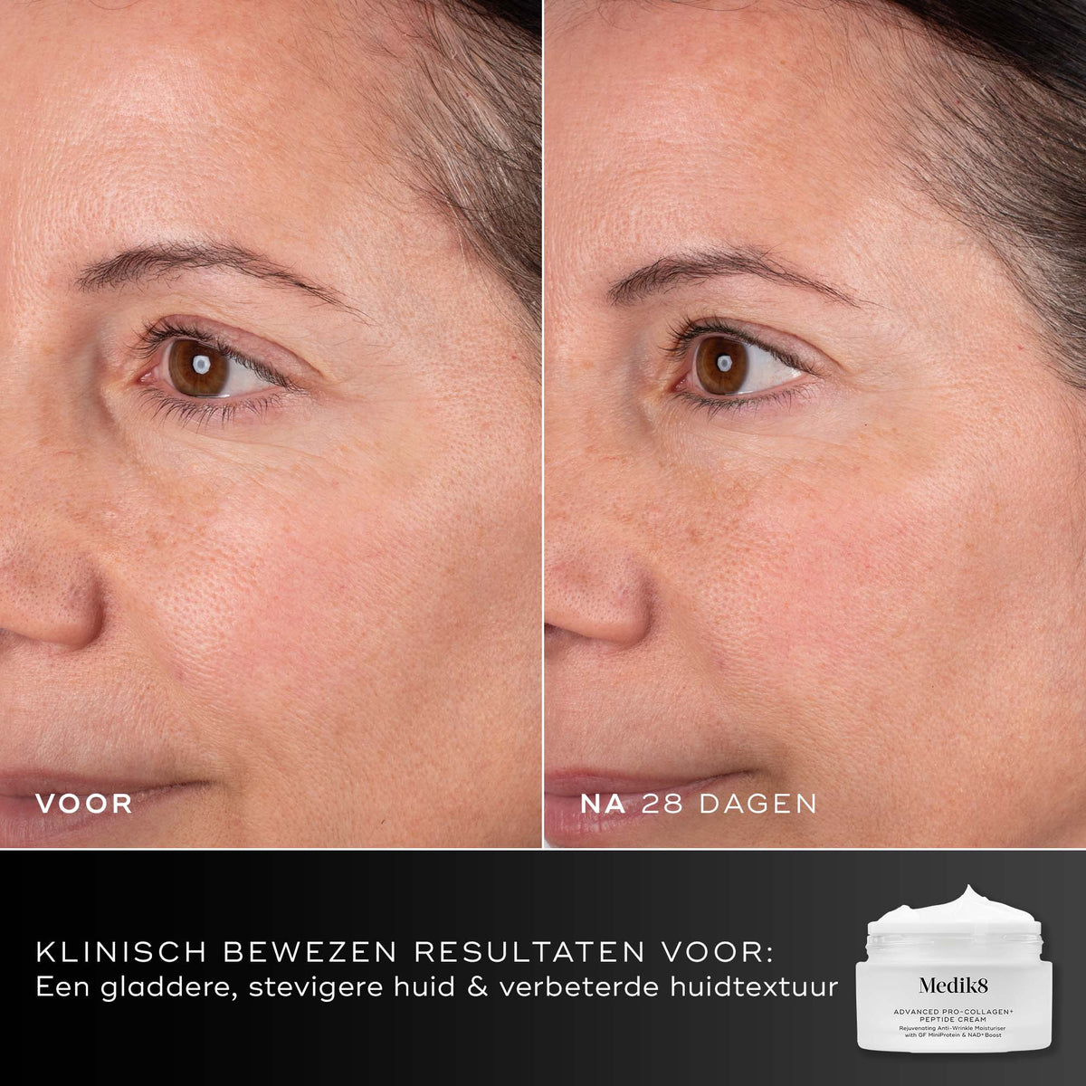 Medik8 Advanced Pro Collagen+ Peptide Cream 50ml før og efter resultat to