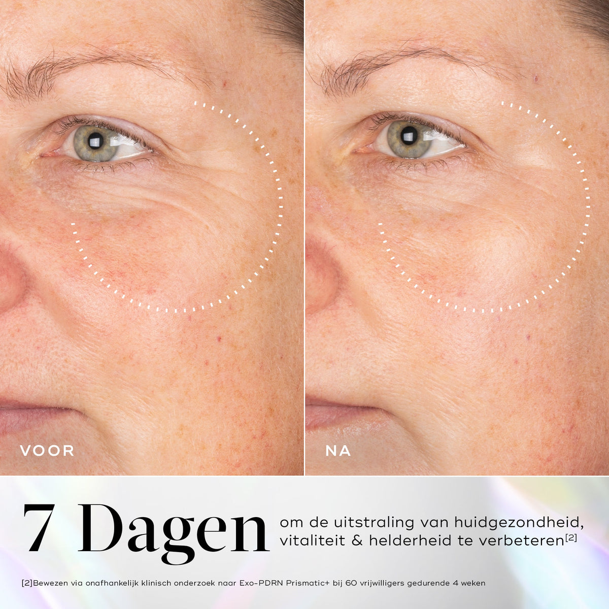 Medik8 Exo-PDRN Prismatic+ 30ml før og efter resultat to