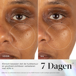 Medik8 Exo-PDRN Prismatic+ 30ml før og efter resultat tre