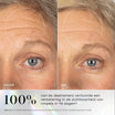 Medik8 Exo-PDRN Prismatic+ 30ml før og efter resultat