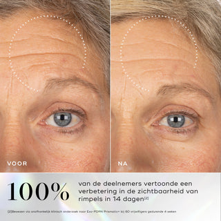 Medik8 Exo-PDRN Prismatic+ 30ml før og efter resultat