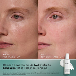 Medik8 Total Moisture Cleansing Gel 145ml før og efter resultat