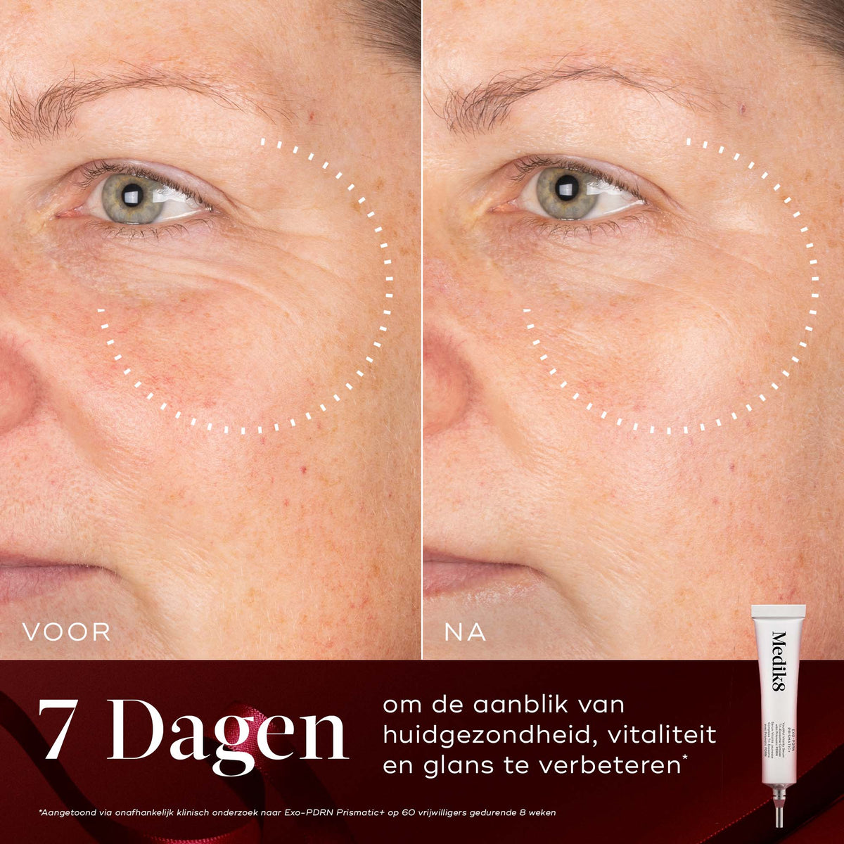 Medik8 Rejuvenation Routine Exo-PDRN Prismatic+ før og efter resultat
