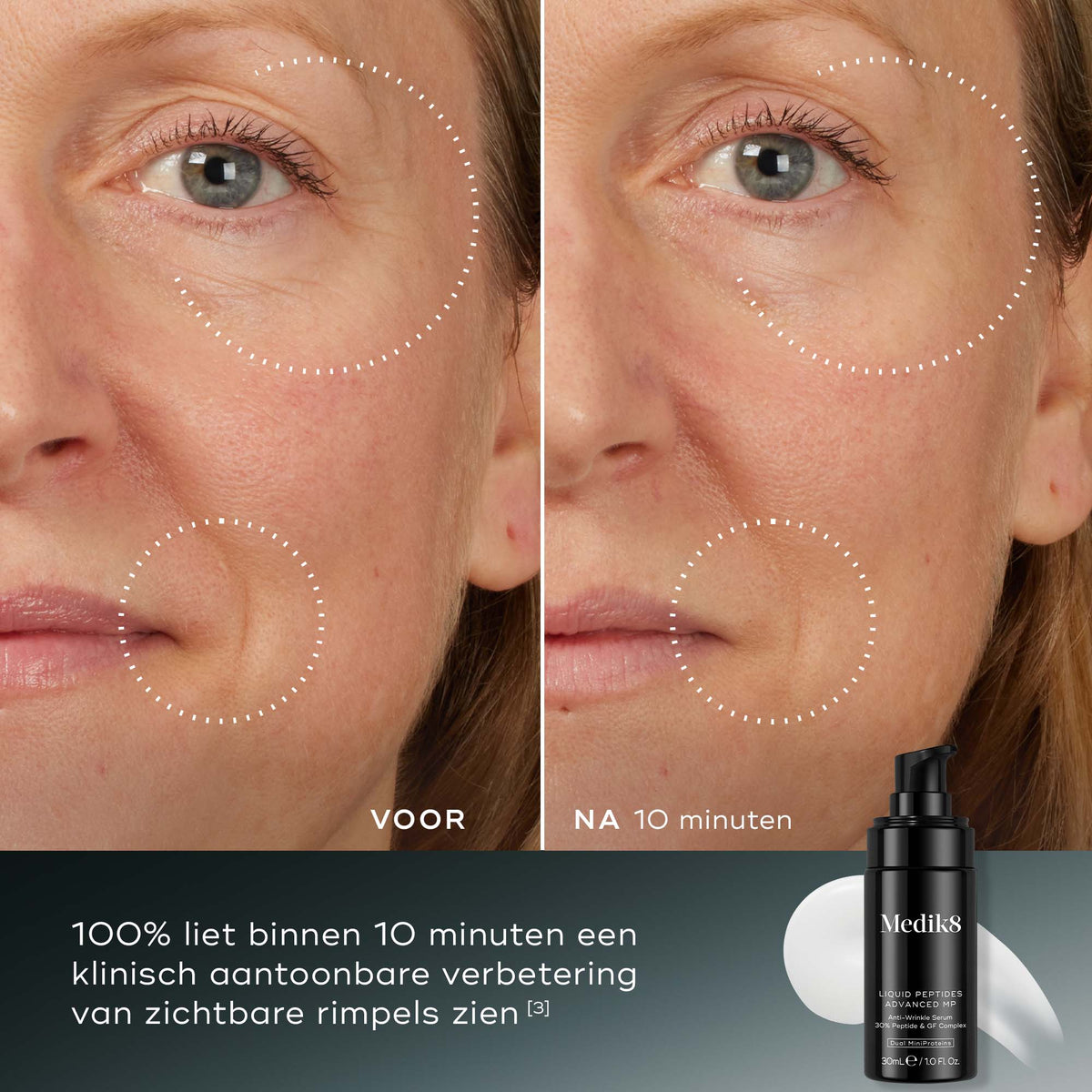 Medik8 Liquid Peptides Advanced MP 30ml før og efter resultat to