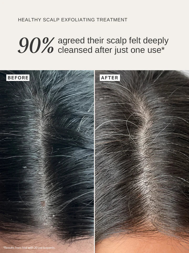 Alpha-H Healthy Scalp Exfoliating Treatment stemningsbillede
