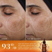 Medik8 Super C Ferulic 30ml før og efter resultat