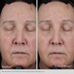 Obagi ELASTIderm Lift up & Sculpt Facial Moisturizer effect