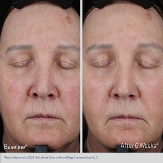 Obagi ELASTIderm Lift up & Sculpt Facial Moisturizer effect
