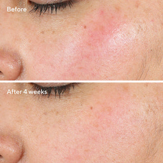 Intense Recovery Cream 50ml | Murad