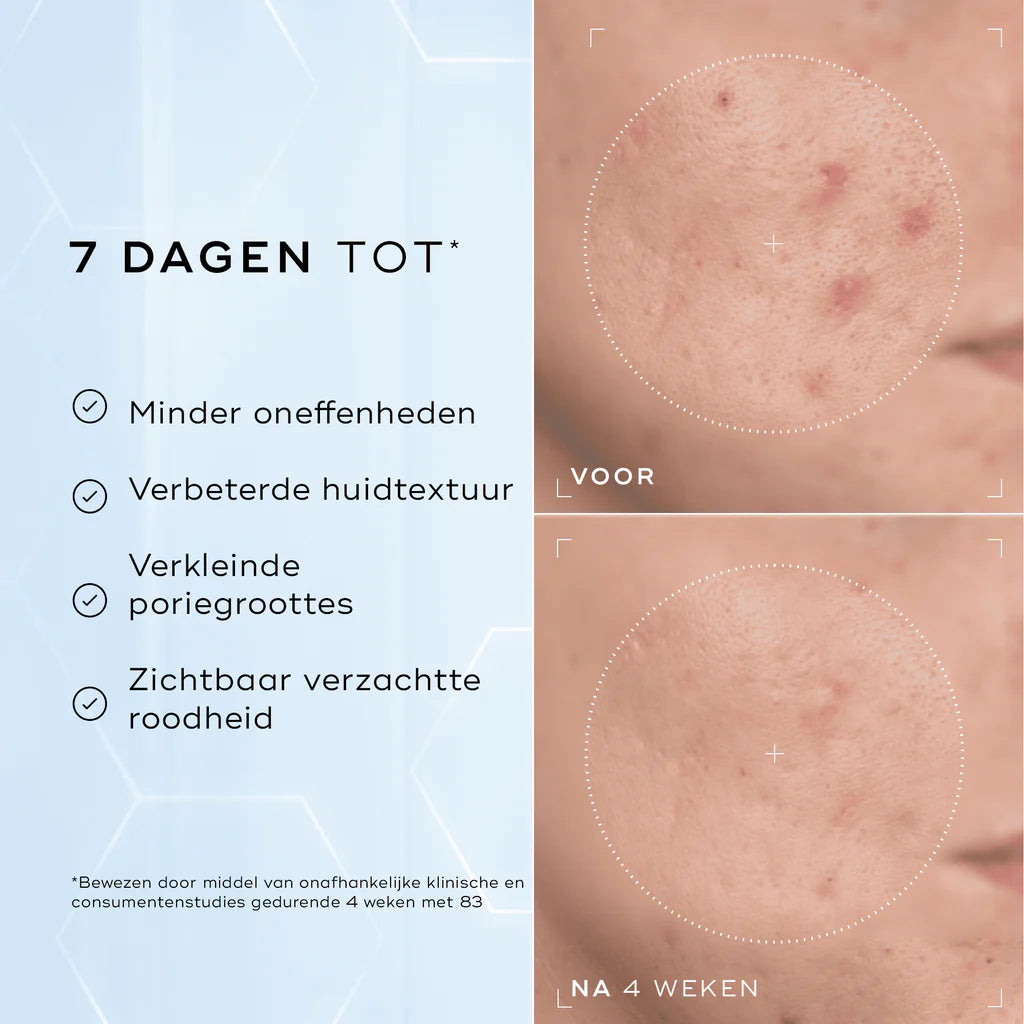 Medik8 Niacinamide peptides 30ml før og efter 4 uger