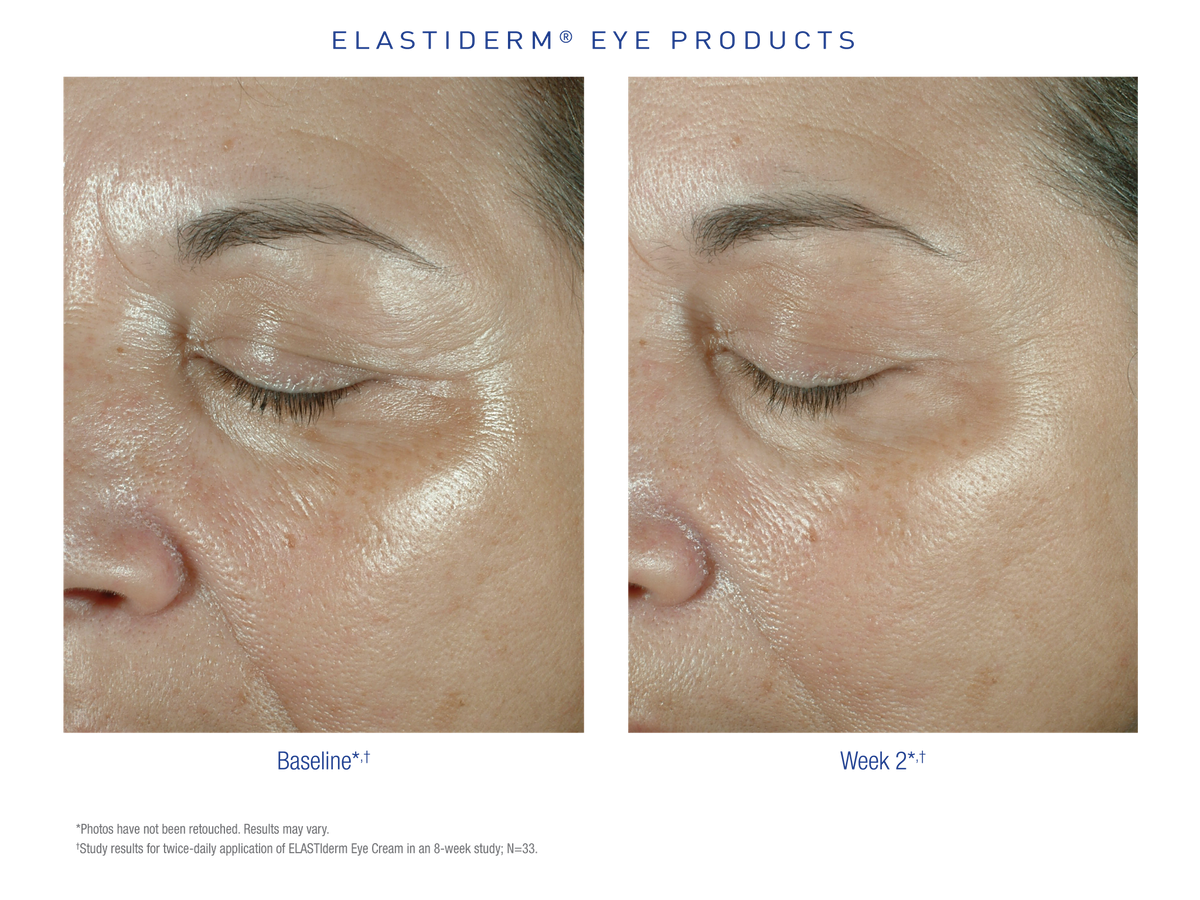 Obagi Elastiderm Eye Cream stemningsbillede