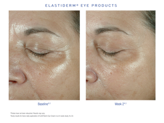 Obagi Elastiderm Eye Cream ambiance