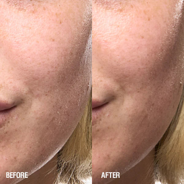 Grown Alchemist Skin Renewal Serum før og efter