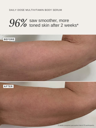 Alpha-H Daily Dose Multi-Vitamin Glow Body Serum før og efter arm