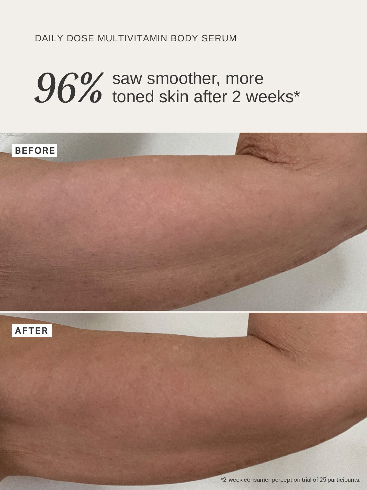 Alpha-H Daily Dose Multivitamin Body Serum før og efter arm