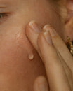 Alpha-H Instant Action BHA Blemish Treatment påført på en bums