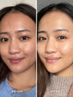 Alpha-H Liquid Gold Exfoliating Treatment før og efter resultat tre