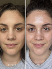 Alpha-H Liquid Gold Exfoliating Treatment før og efter resultat to