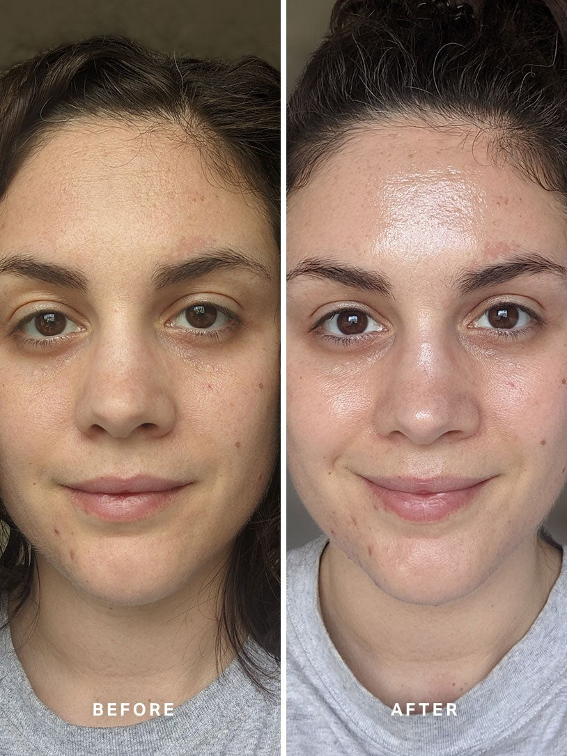 Alpha-H Liquid Gold Exfoliating Treatment før og efter resultat to