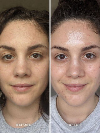Alpha-H Liquid Gold Exfoliating Treatment før og efter resultat to