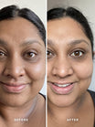 Alpha-H Liquid Gold Exfoliating Treatment før og efter resultat fire