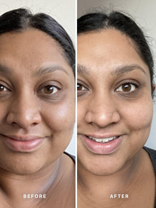 Alpha-H Liquid Gold Exfoliating Treatment før og efter resultat fire