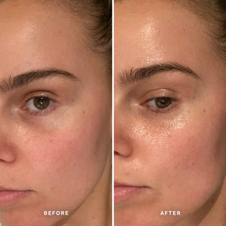 Alpha-H Midnight Reboot Serum før og efter resultat tre