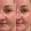 Alpha-H Midnight Reboot Serum før og efter resultat to