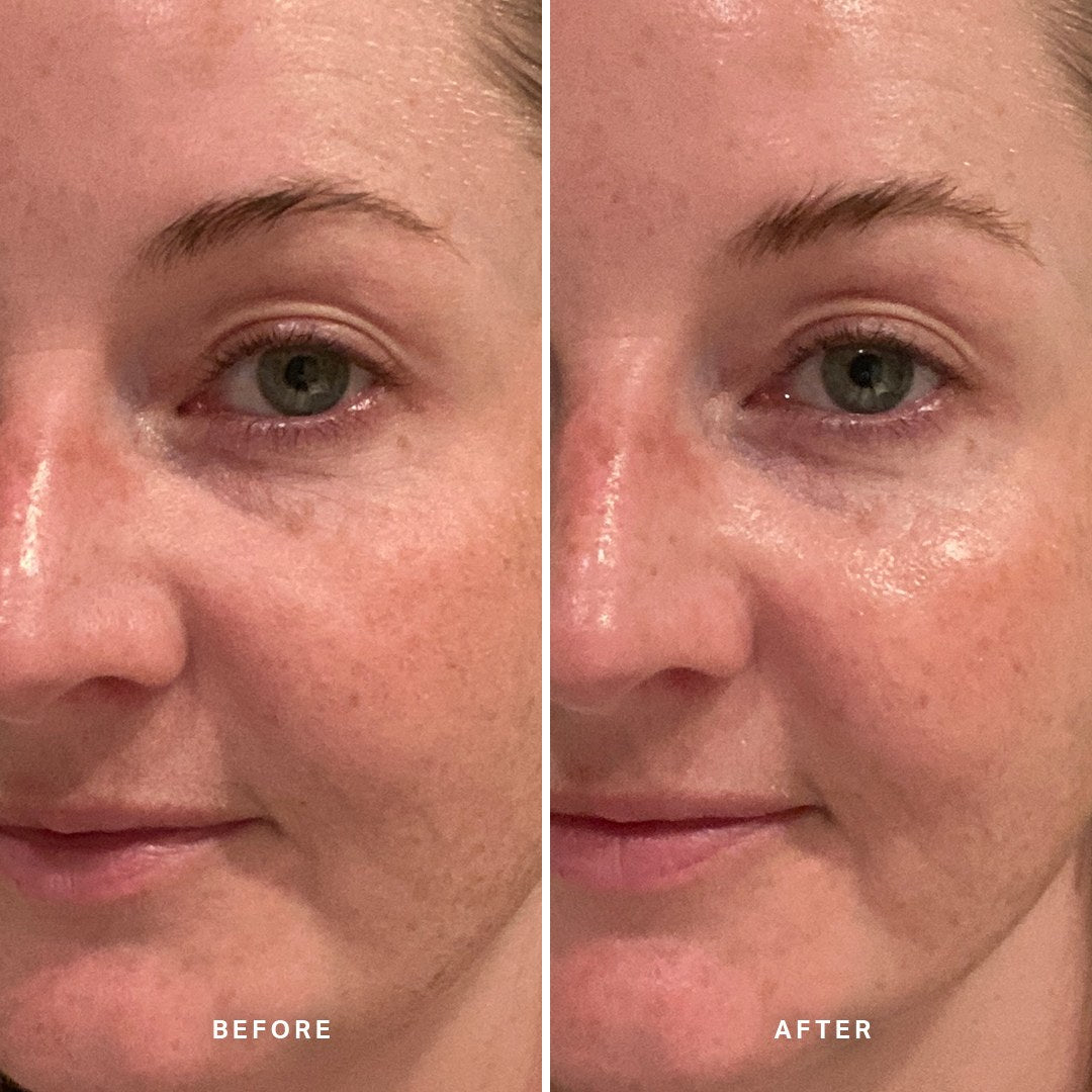 Alpha-H Midnight Reboot Serum før og efter resultat to