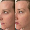 Alpha-H Midnight Reboot Serum før og efter resultat fire