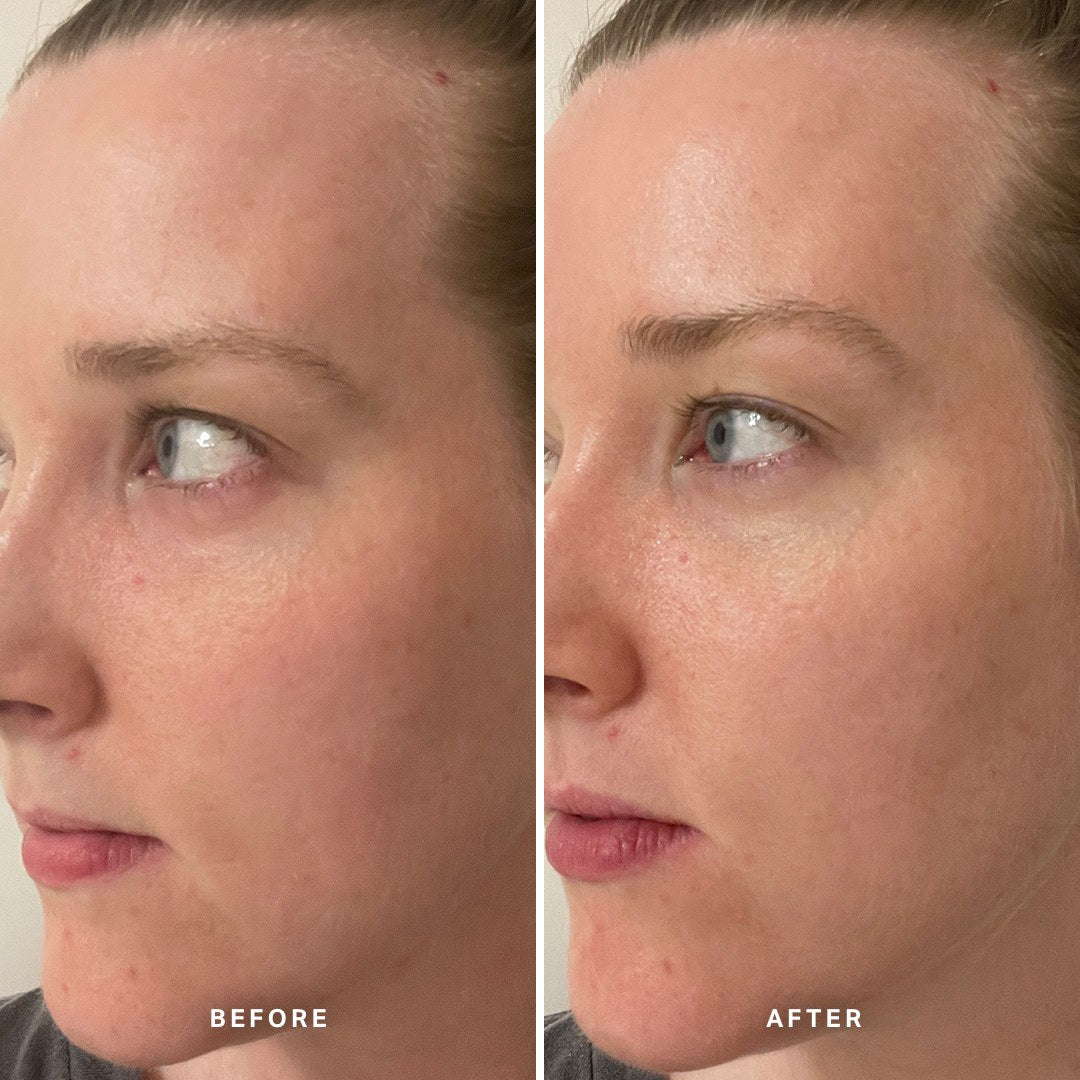 Alpha-H Midnight Reboot Serum før og efter resultat fire