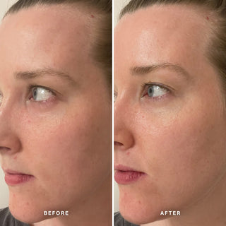 Alpha-H Midnight Reboot Serum før og efter resultat fire