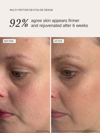 Alpha-H Multi-Peptide Revitalise Serum før og efter resultat tre