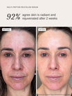 Alpha-H Multi-Peptide Revitalise Serum før og efter resultat to