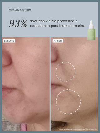 Alpha-H Vitamin A Serum før og efter mindre synlige porer