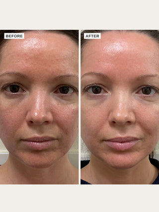 Alpha-H Vitamin B Serum før og efter resultat tre